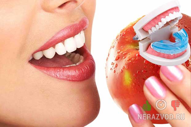 Капа Dental Trainer для выравнивания зубов