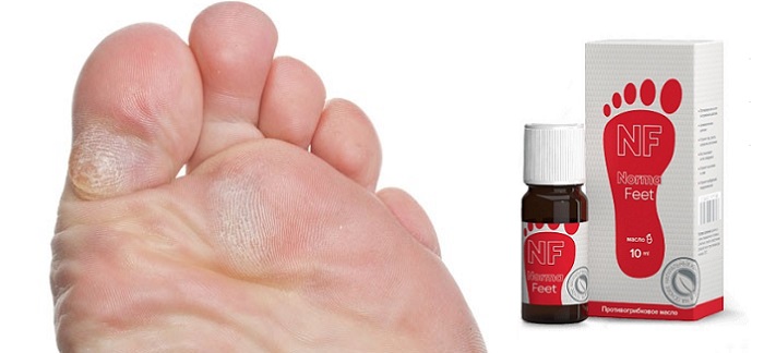 НормаФит масло от грибка ногтей и ног: устранит не только симптомы, но и причины грибковой инфекции!