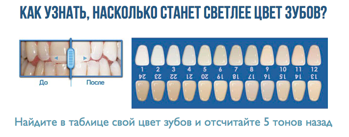 Эффект прибора для отбеливания зубов Luma Smile Люма Смайл